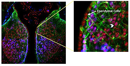 Figure 1: Transcription factor REST...